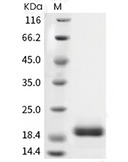 IL-6 Protein, Human, Recombinant