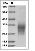 IL-31 Protein, Human, Recombinant (His)