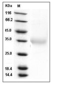 IL-24 Protein, Human, Recombinant (His)