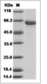 Influenza A H5N1 (A/bar-headed goose/Qinghai/1A/2005) Hemagglutinin/HA Protein (His)