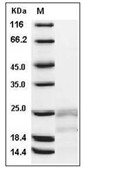 IFN gamma Protein, Human, Recombinant