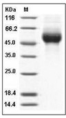 Influenza A H1N1 (A/Brevig Mission/1/1918) Hemagglutinin Protein (His)