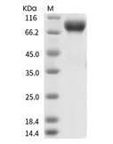 Influenza A H1N1 (A/Guangdong-Maonan/SWL1536/2019)/(A/Hawaii/70/2019) Hemagglutinin/HA Protein (His)