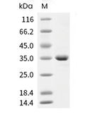 FGL1 Protein, Human, Recombinant (His)