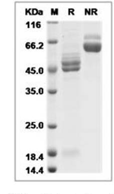 Human respiratory syncytial virus (RSV) (A2) Fusion glycoprotein/RSV-F Protein (His)