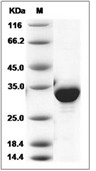 NQO1 Protein, Human, Recombinant (His)