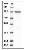 MEK2 Protein, Human, Recombinant (GST)