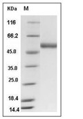 ENTPD3 Protein, Human, Recombinant (His)