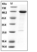 HDAC8 Protein, Human, Recombinant (GST)