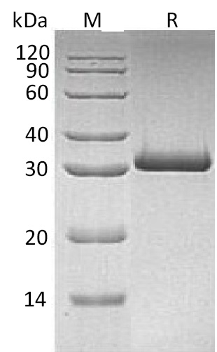 MBL2 Protein, Human, Recombinant (His)